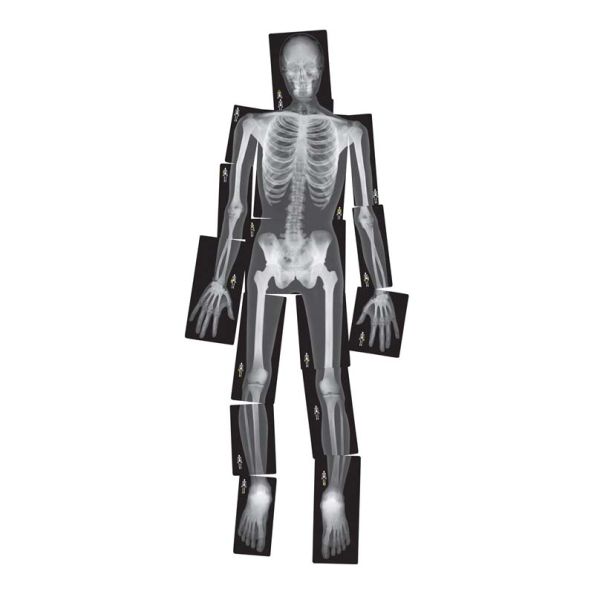 Life-Size Human X-Rays | Creative Activity